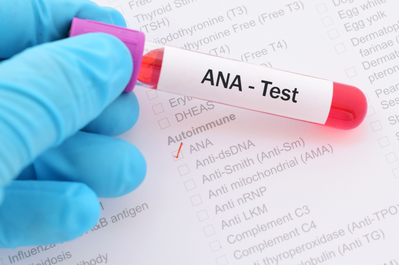 ANA testing