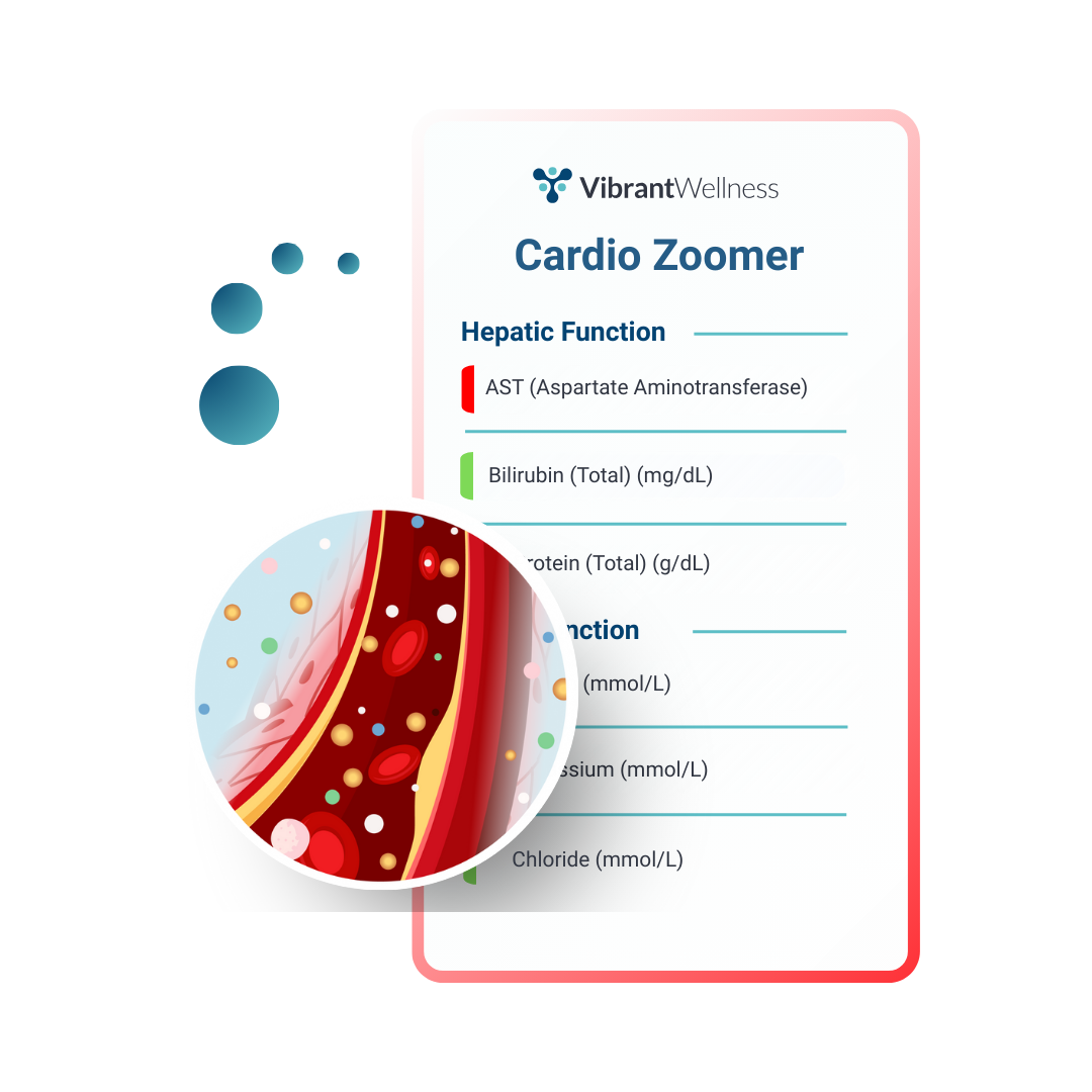Cardio Zoomer Sample Report Mockup-1