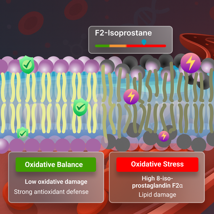 Oxidative Stress Lipid Damage
