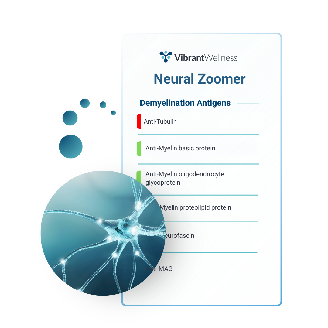 Neural Zoomer Sample Report Mockup