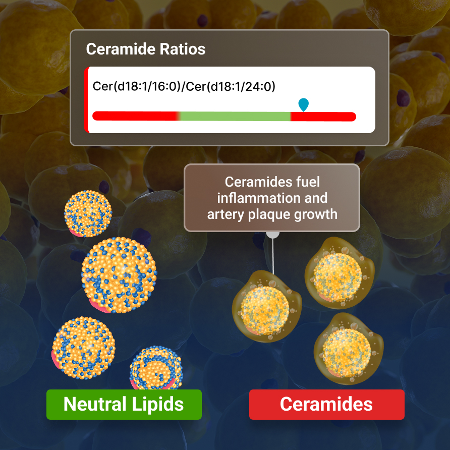 Ceramides
