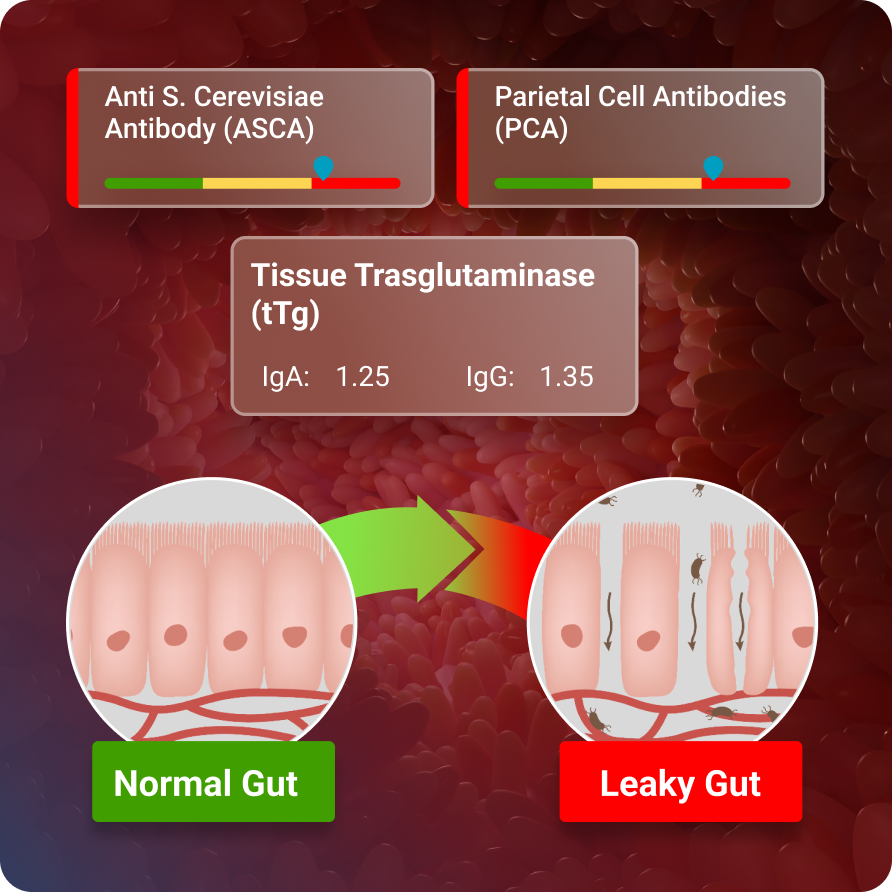 Immune Zoomer | Comprehensive Autoimmune Test | Vibrant Wellness