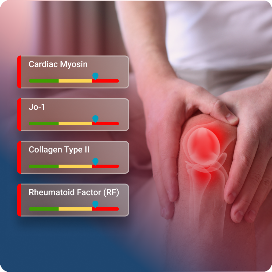Joint-Muscle-Connective-Tissue