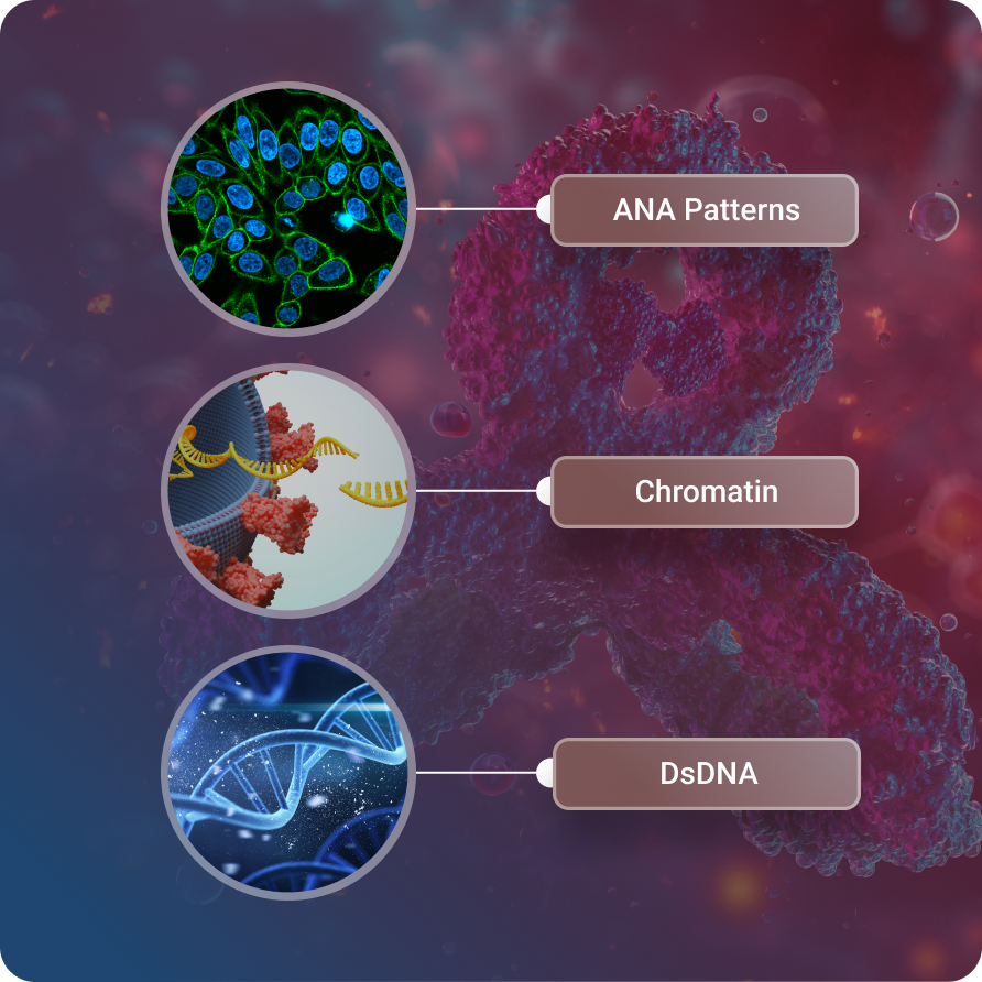 Systemic-Autoimmunity
