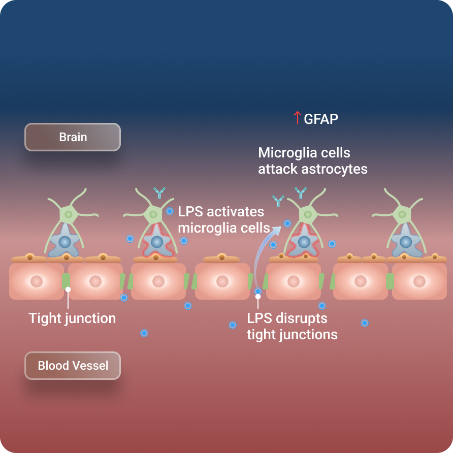 Infection-Associated-Immune