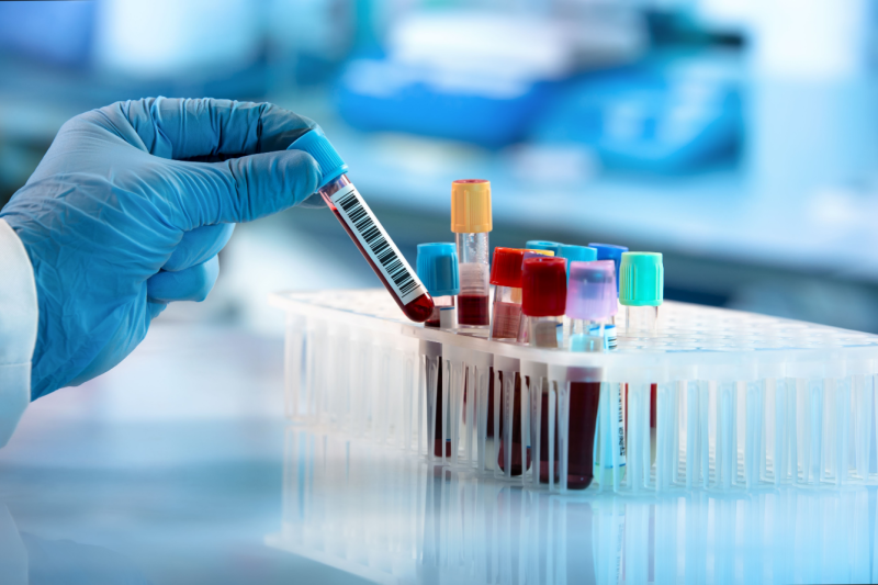 lab testing