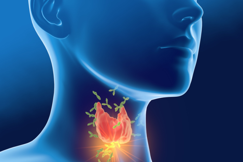 thyroid antibodies