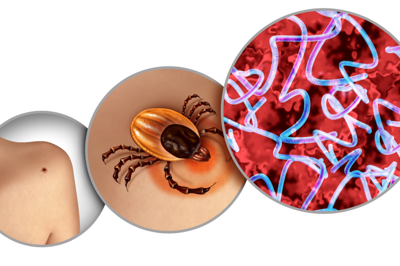 tick bite