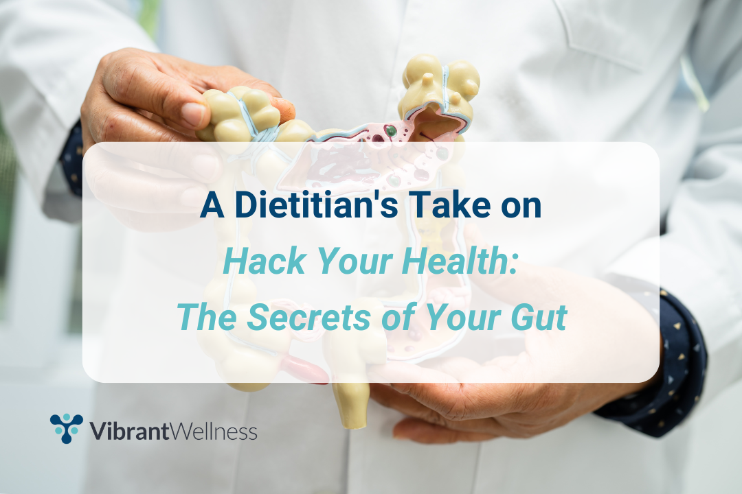 Dietitian holding a model of the gut