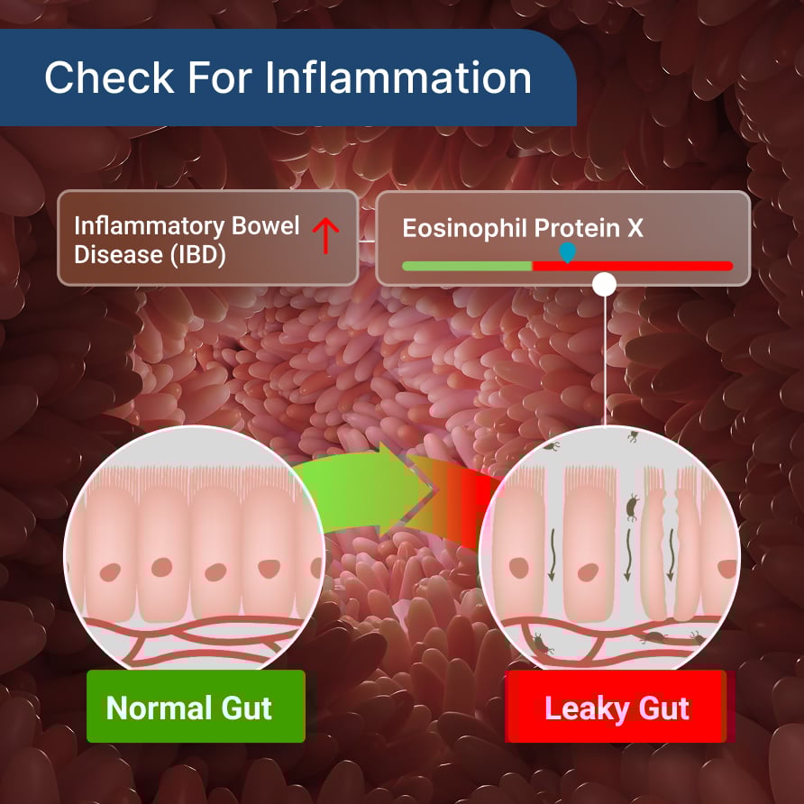 Check-for-Inflammation