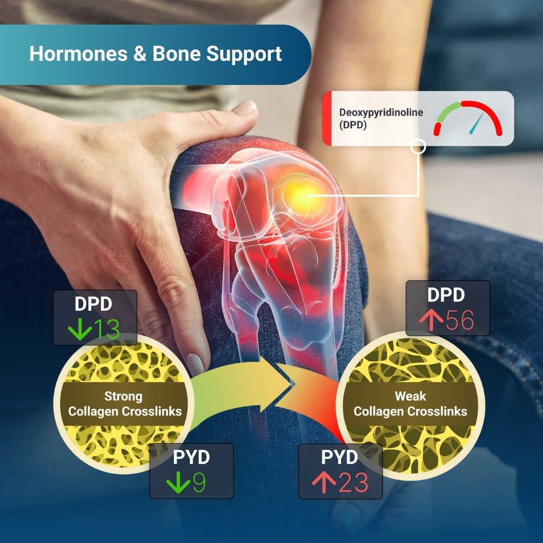 Hormones-Bone-Support